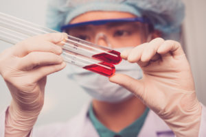 Диагностика описторхоза: причины, симптомы и как определить описторхоз у человека