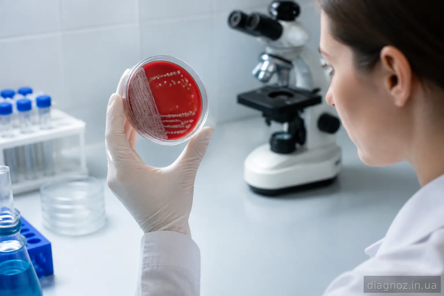 Лабораторне дослідження бактерії Helicobacter pylori