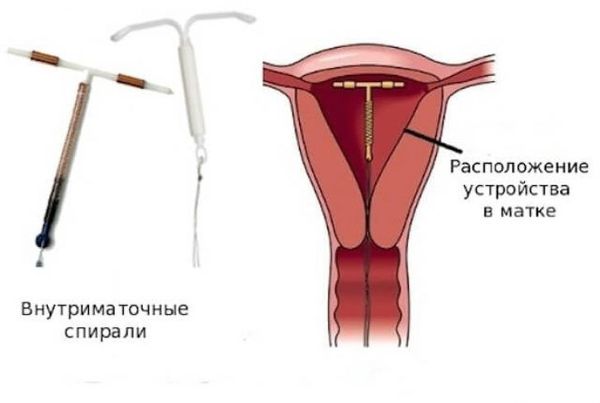 Альгодисменорея: причини, симптоми та лікування