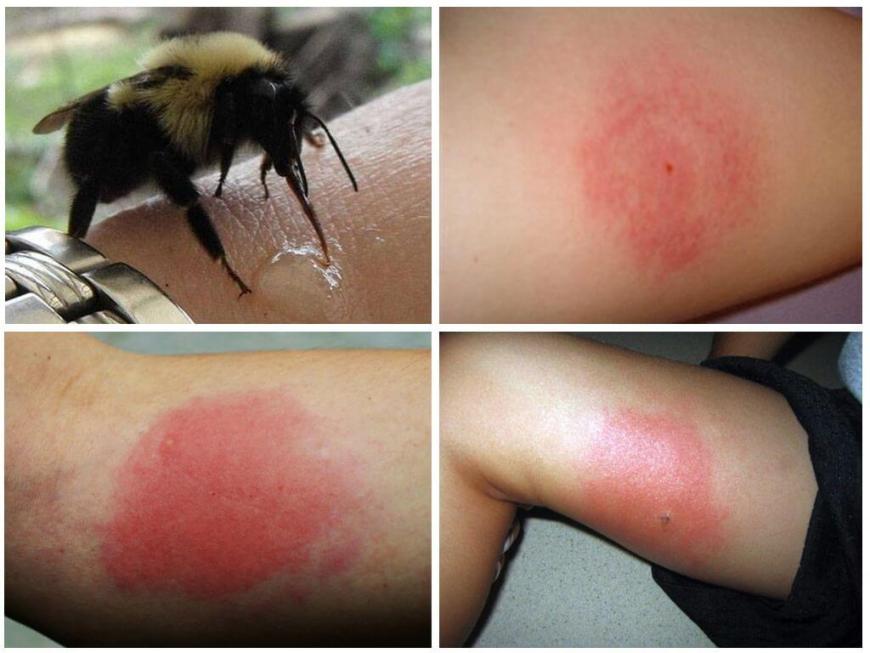 https://diagnoz.in.ua/nevidkladna-dopomoga/pri-ukusakh/